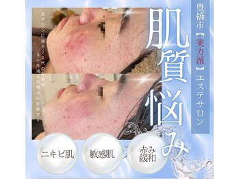 シグネット(Cygnet)の写真/【都度払い専門】エステが初めてでも安心♪あなたに合わせたメニューと決められた予算で安心エステを提供