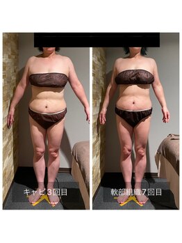 サンタイ(santai.)/筋膜リリース