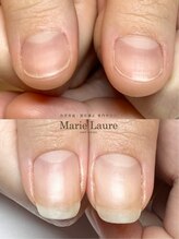 マリーロール 梅田店(Marie Laure)/自爪育成/深爪矯正/ネイルケア
