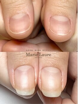 マリーロール 梅田店(Marie Laure)/自爪育成/深爪矯正/ネイルケア