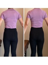 エスアップ 麻布十番店(THE S-UP)/施術前後写真