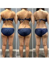 プリマプリート 可児店/脂肪冷却！通い放題中！