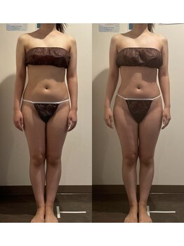 デトックスサロン モーミン/スリムムーヴ