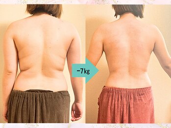 つばききよら/4ヶ月で―7キロ！別人のお背中