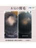 【導入キャンペーン特別価格】プロセル頭皮　育毛促進￥55,000→