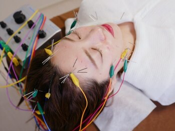 つつじが丘整骨院鍼灸マッサージ院の写真/【お顔の引き締めを実感！】プライベート空間で豊富な美容鍼メニューが体験できます。たるみケアに最適◎