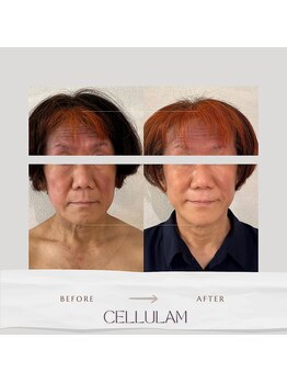 セル ノ ネ(Cell ne)/敏感肌の方にも