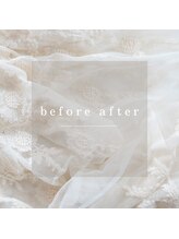 サラン(SALON)/ビフォーアフター