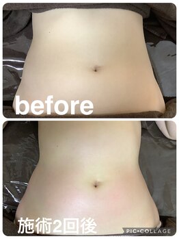 ギンザアール(GINZA R.)/くびれ爆誕◎