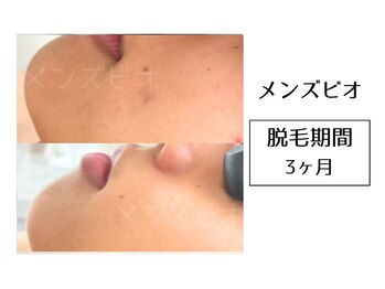 メンズビオ 神戸三宮店/