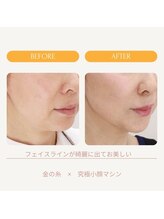 ムーンライズ(moonrise)/