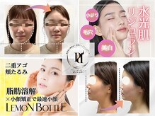 ポーベルポー(Peau Belle poe)