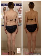 小顔コルギ専門店 フェルーシュ 成田駅前店(Feruche)/50代女性　結果写真