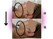 カリアンヌ/温活かっさフェイシャル/小顔