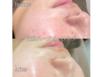 エムラボ 池袋店(M LABO)/ビフォーアフター