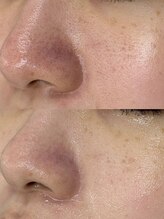 ヴェリス 福岡店(Velisse)/