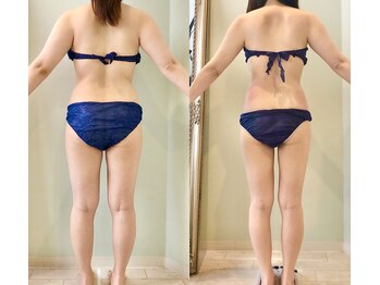 エリュクス(et Luxe)の写真/【３６０°脂肪冷却】と【ヴィーナスDIVA】で全方位から頑固な脂肪もタルミも浮腫みもセルライトも全て撃退