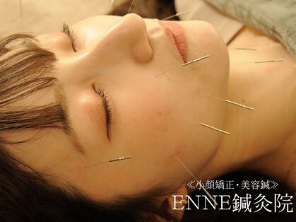 エンネ鍼灸院(ENNE鍼灸院)の写真