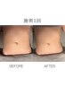 【痩身引き締めボディメイク】最新美容機器２ヶ所+全身トリートメント/110分