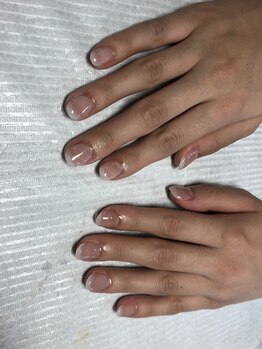 アクア ライズ 上大岡店(Aqua Rise)/【深爪矯正】