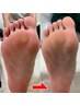 【足裏の悩みに】タコ・角質除去★【今だけモニター価格】¥4400