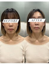 シロ(silo.)/ヒーリングケアクーポン