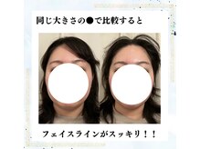 ハイファイブ(Hi-Five)/ポテンツァ/（施術1回）