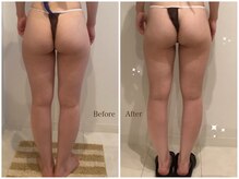 ローズハニー 小田原店/下半身集中痩せ 【5800円】