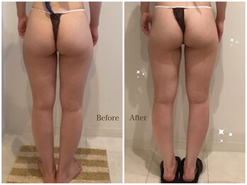 ローズハニー 小田原店/下半身集中痩せ 【5800円】