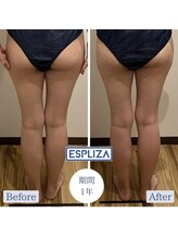 エスプライザ 鹿児島天文館店(ESPLIZA)/