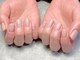 モーダアッカ(moda acca)の写真/《烏丸/四条》巻き爪・深爪が気になる方へ！爪の形を整え、お悩みを改善します♪クーポン多数ご用意☆