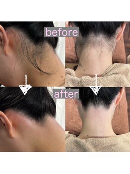 ルリアン カルム/【うなじWAX】