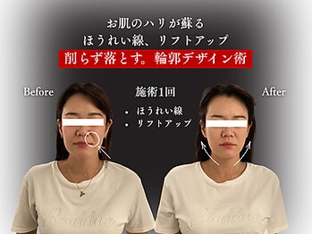 整体と美容鍼 無名