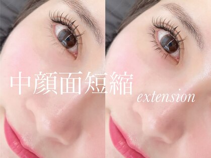 トレア(TREA)の写真