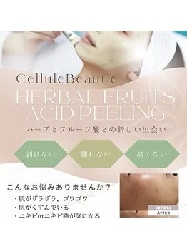 リコンディショニング ビューティー アール(Re.conditioning beauty R)/ハーバルピーリング