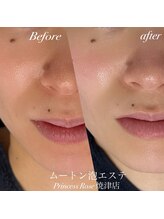 キレイシェア バイ プリンセスローズ静岡駅店(KIREI SHARE)/ムートン泡エステ