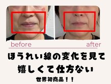 コモド
