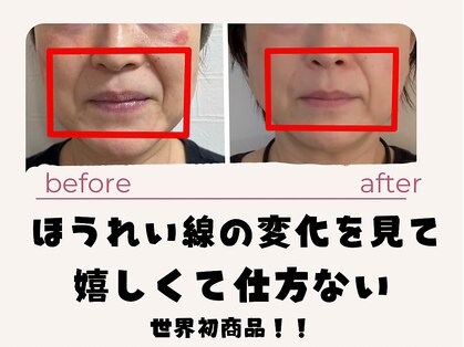 コモドの写真