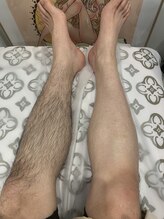 アート 熊本並木坂店(ART)/フラッシュワックス脱毛/ひざ下