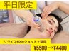 【平日限定】小顔美肌マシン『リライフ』4000ショット＋整顔￥5500 →¥4400