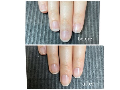 ララネイル(lala nail)の写真