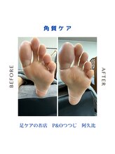 ピーアンドオー(P&O)/