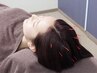 【食いしばりのある方おススメ】 美容鍼＋全身トータル鍼 90分 ¥8,000