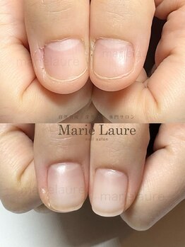マリーロール 淀屋橋本店(Marie Laure)/自爪育成/深爪矯正/ネイルケア