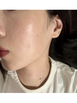 カムイ/お肌のお悩み全て1つで完結♪