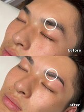 マグ 藤枝店(Mag)/アイブロウビフォーアフター