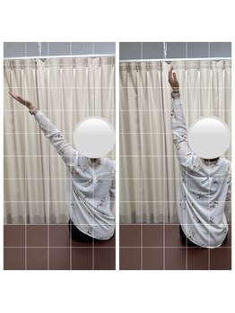 ナオル整体 人形町店(NAORU整体)/猫背姿勢/姿勢矯正/可動域改善