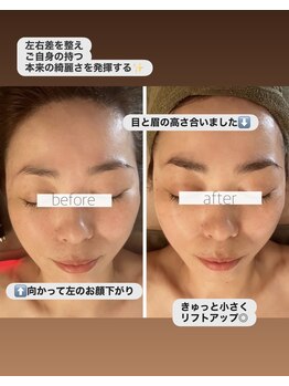 パル コルギサロン(Pal. Korugi salon)/コルギビフォーアフター