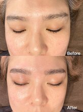 パピヨン(papillon)/ハリウッドブロウリフト【HBL】