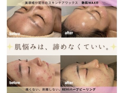 リルビー(Lilby)の写真